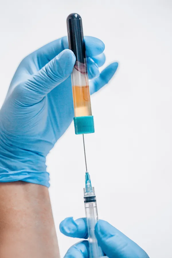 PRP-Vampire-Facelift-Treatment A close-up of a medical practitioner's gloved hands drawing plasma from a vial into a syringe, representing PRP Vampire Facelift treatment from Healthy Aging Medical Centers of New Jersey in Northern New Jersey.