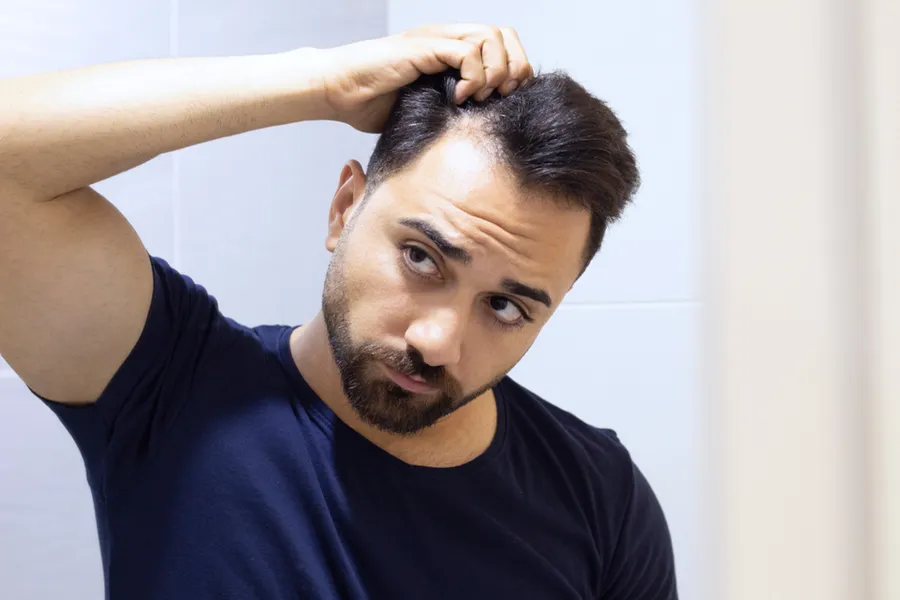 PRP-for-Hair-Loss-Doctor A man in a navy t-shirt looks in the mirror worrying about and touching his receding hairline, considering PRP for hair loss and restoration treatment from Healthy Aging Medical Centers of New Jersey in Northern New Jersey.